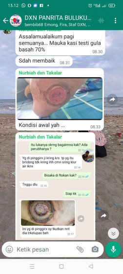 Mr XY, Medan