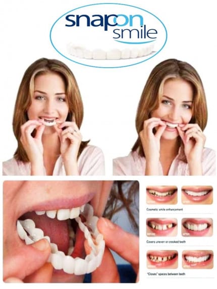 AN - Gigi Palsu Snap on smile R