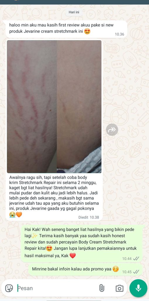 Jevarine Body Cream - Stretchmarks Repair - SF Gratis Ongkir