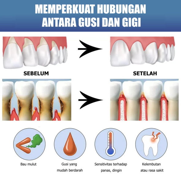 Bottle Cleaner Brush Detail