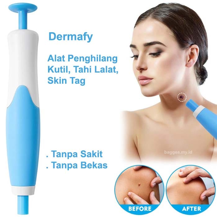 Alat Penghilang Kutil, Tahi Lalat, Skin Tag Dermafy logo