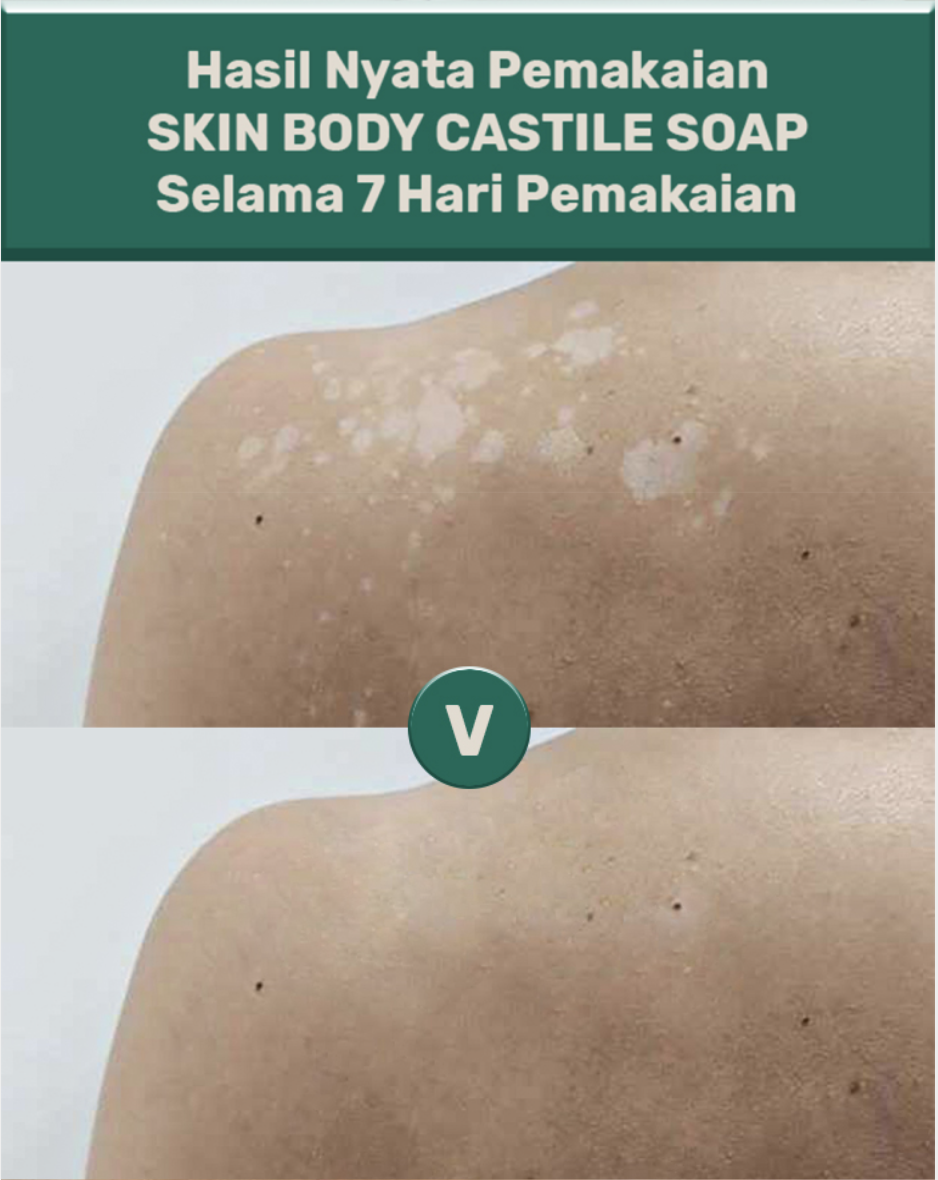 Castile Soap ByJevarine Atasi Panu - FBS