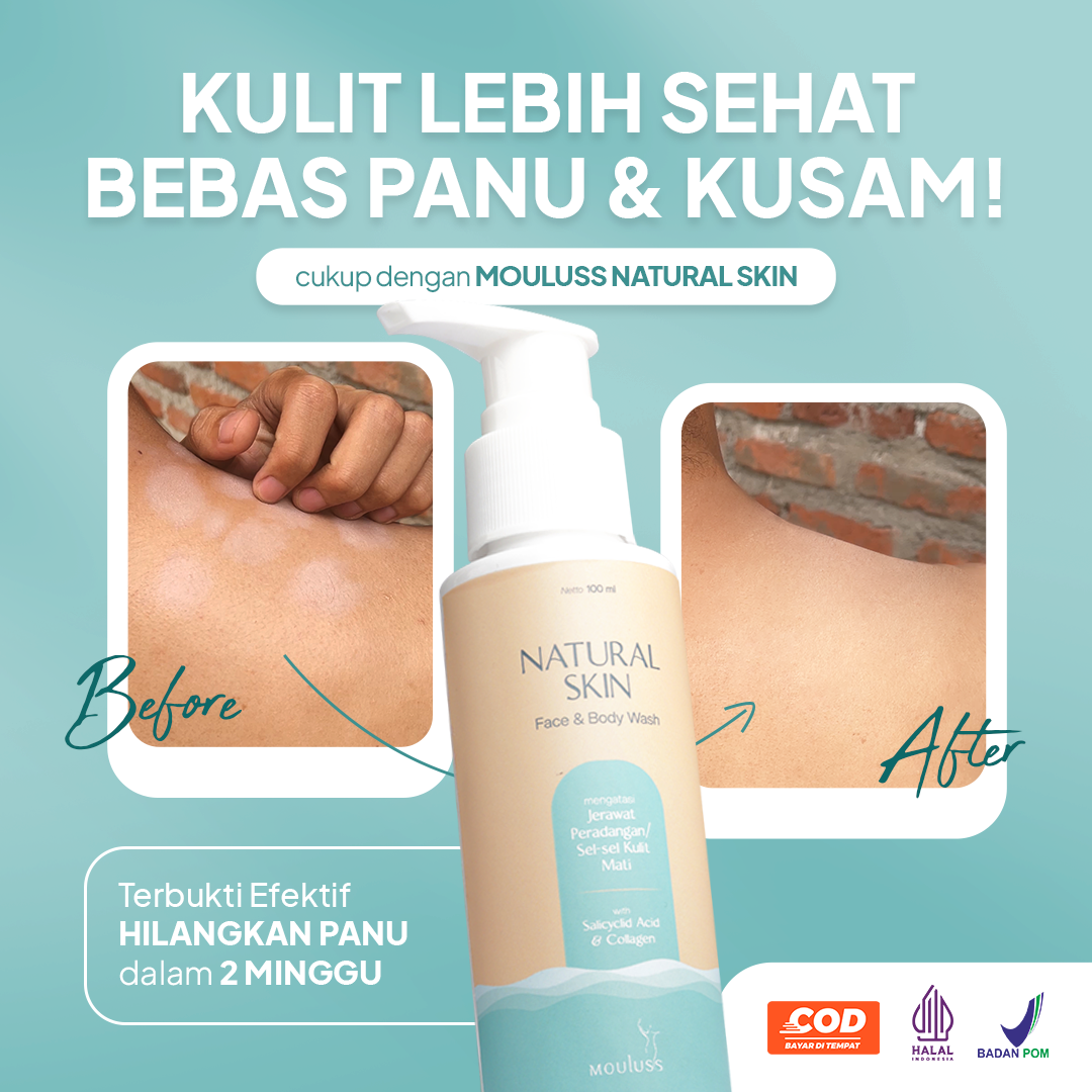 Mouluss Natural Skin - Google new