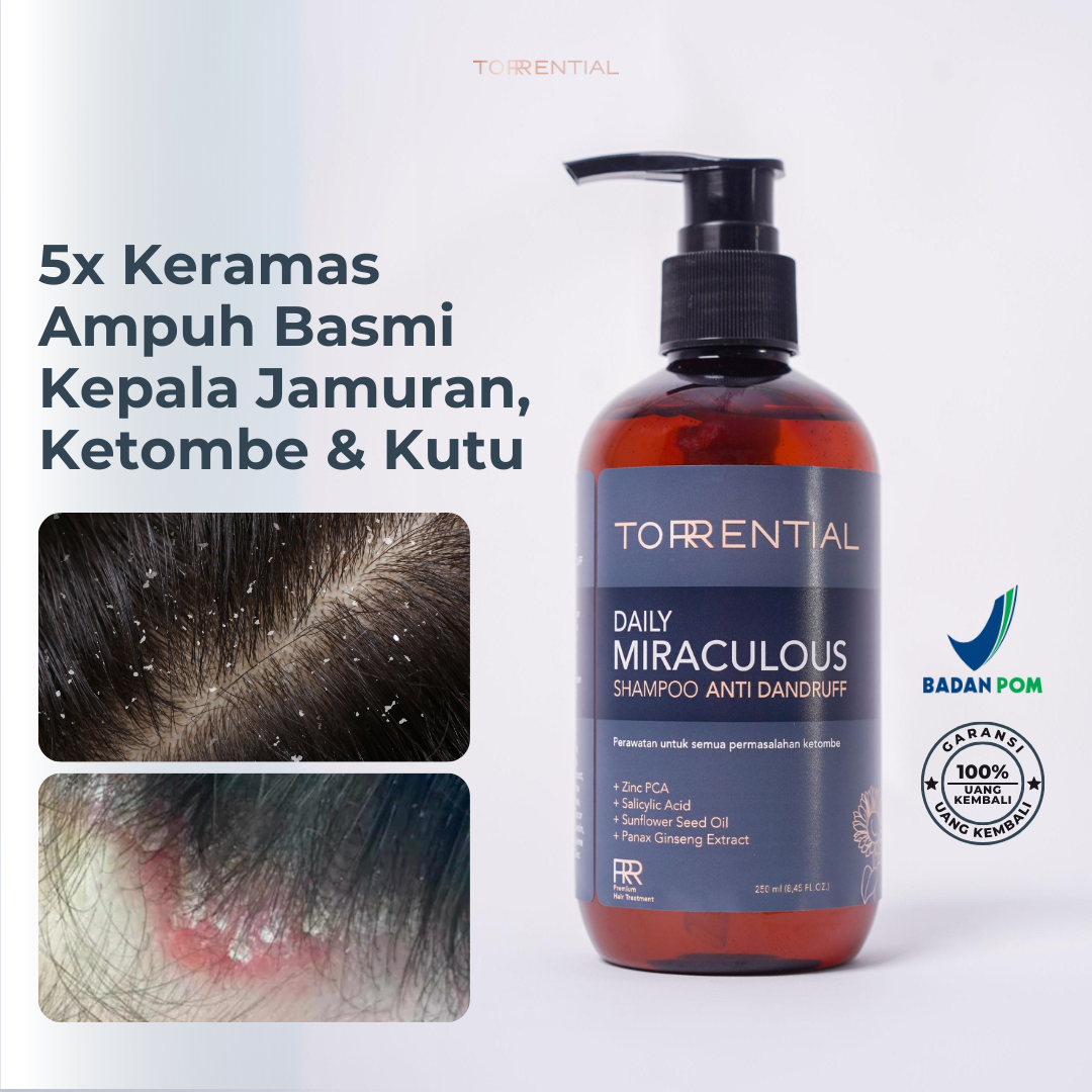 Torrential Shampoo Pembasmi Ketombe & Kutu - Tiktok TTU