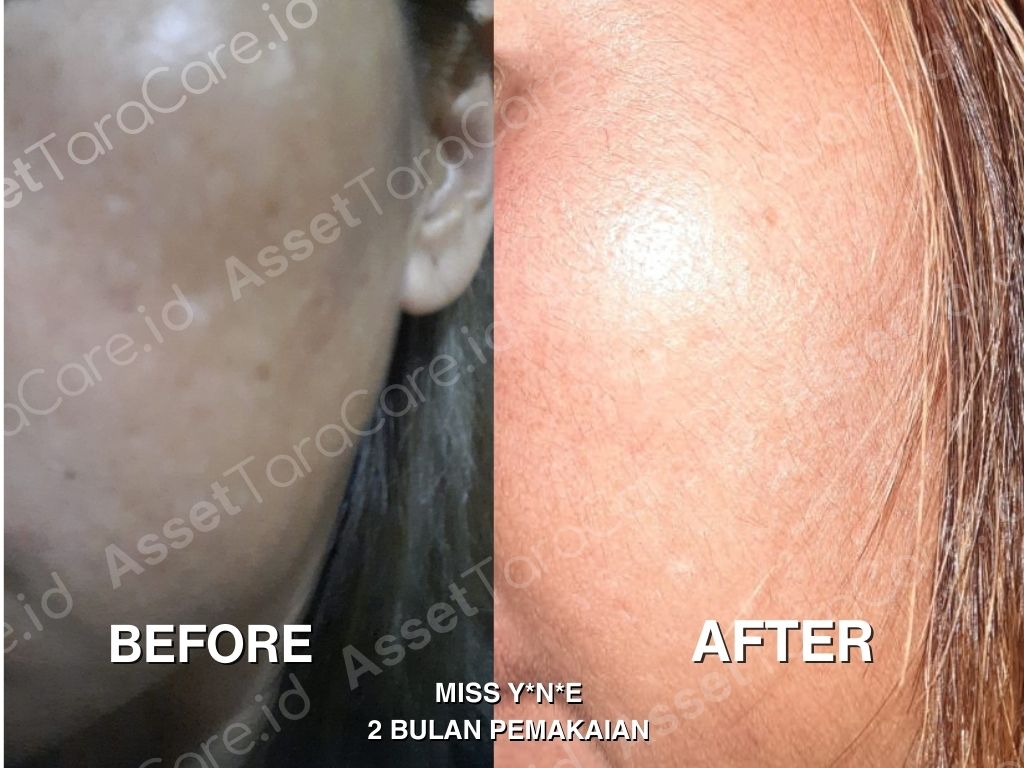 MWO - Taracare Whitening Skincare