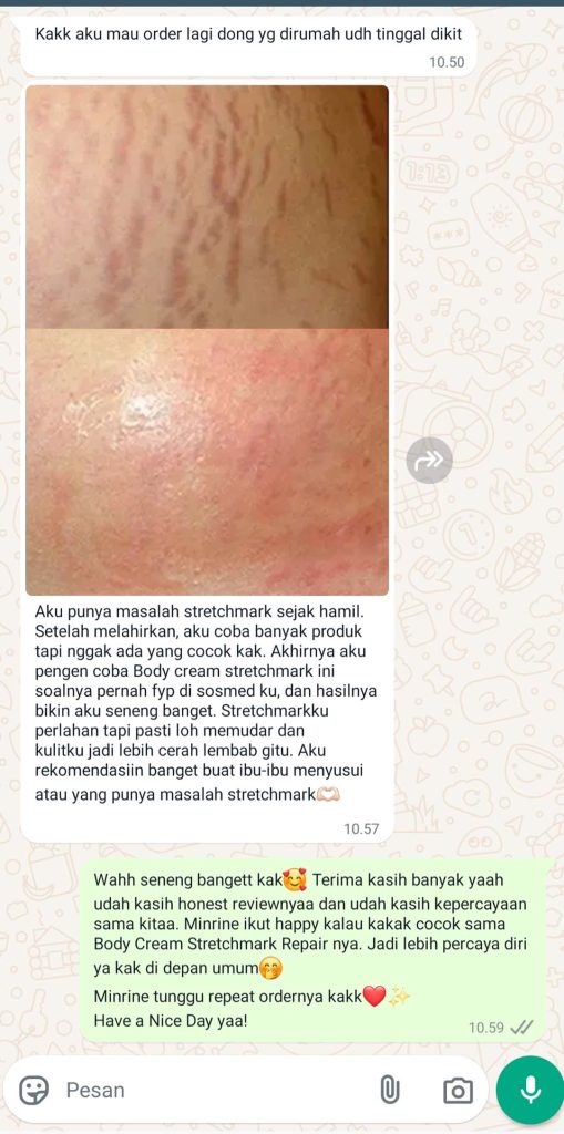 Jevarine Body Cream - Stretchmarks Repair - SF Gratis Ongkir