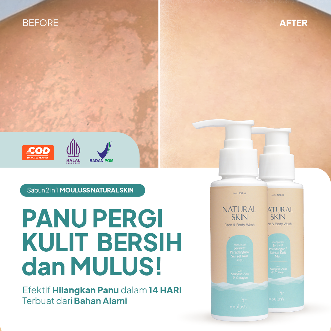 Mouluss Natural Skin - Google new