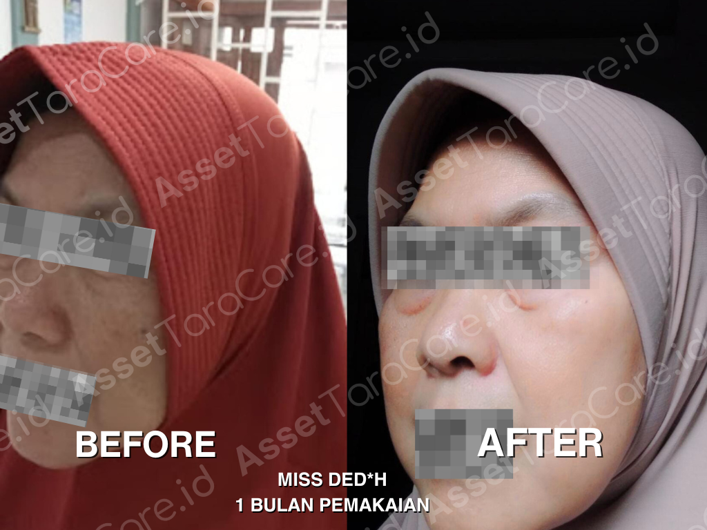 MWO - Taracare Whitening Skincare