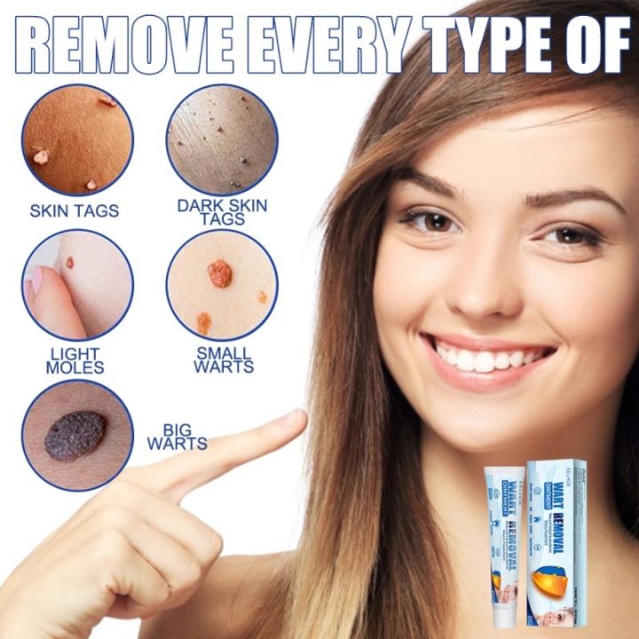 Wart Removal Cream logo