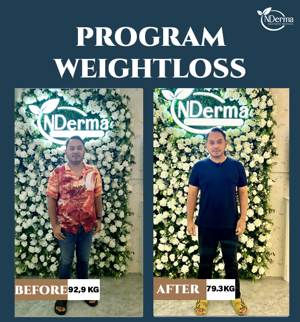 Program Weight Loss logo