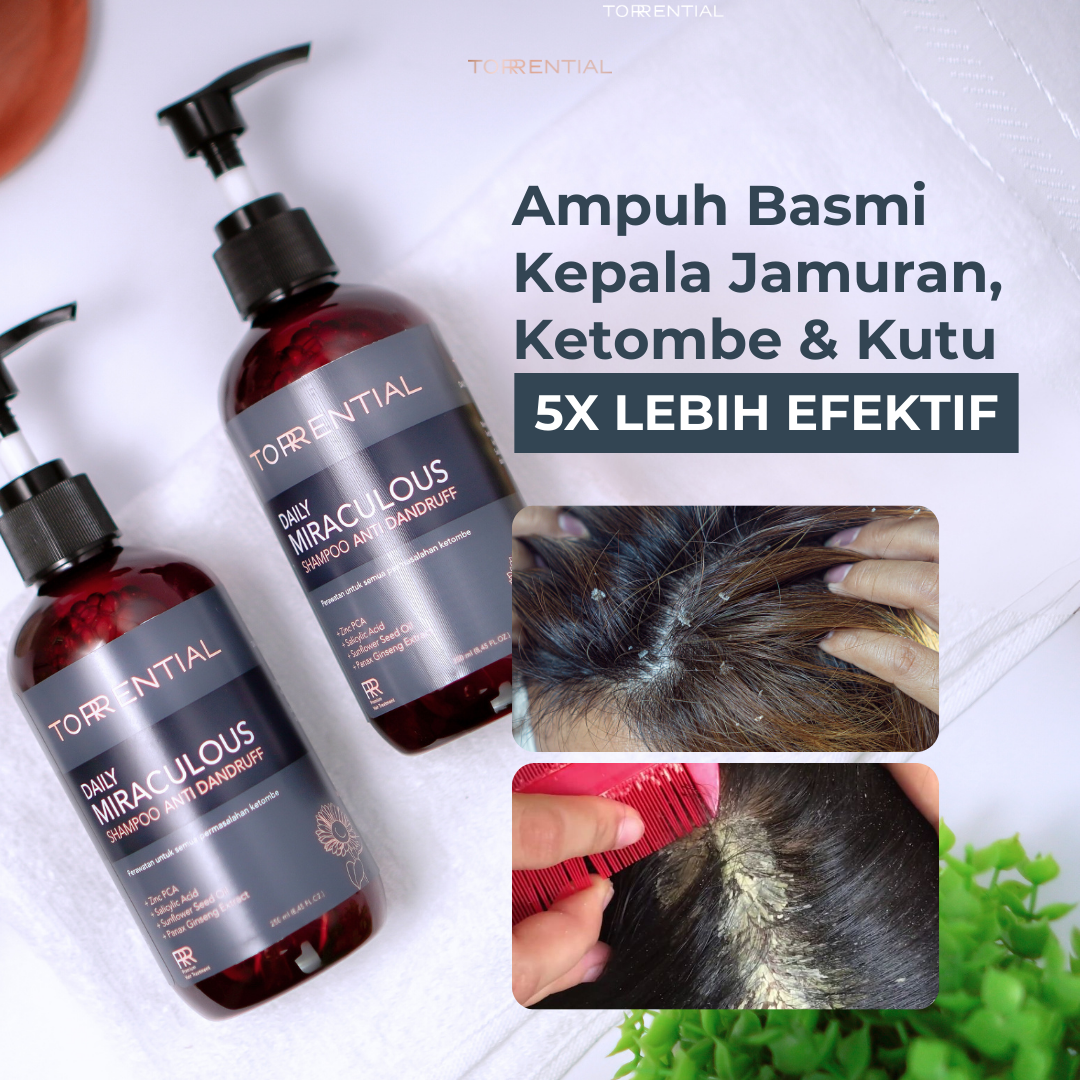 Torrential Shampoo Pembasmi Ketombe & Kutu - Tiktok TTU