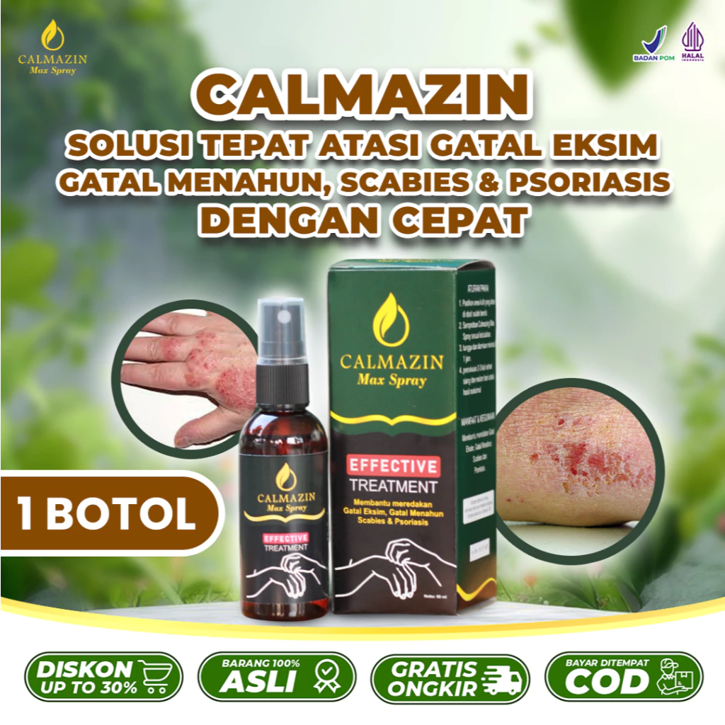 Calmazin Spray Herbal Obat Gatal