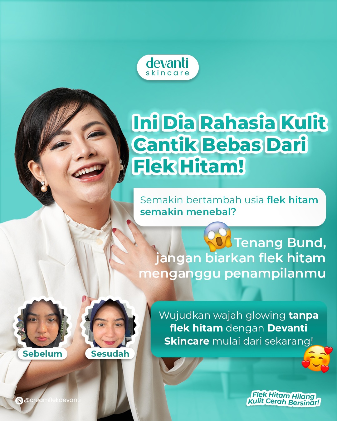 Devanti Promo Hemat | Penghilang Ampuh Flek Hitam Jerawat & Bekasnya (Paket Isi 5 Pcs) + Bonus Pouch
