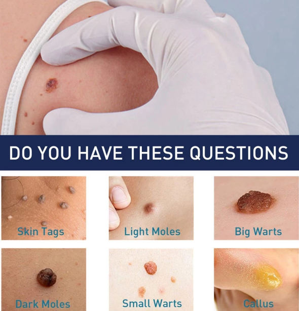 Bottle Cleaner Brush Detail