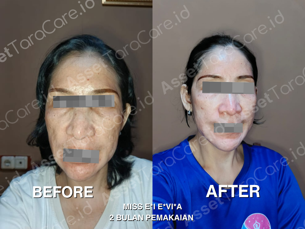 MWO - Taracare Whitening Skincare