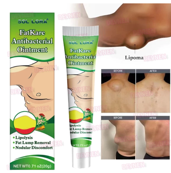 SALEP LIPOMA GMN logo