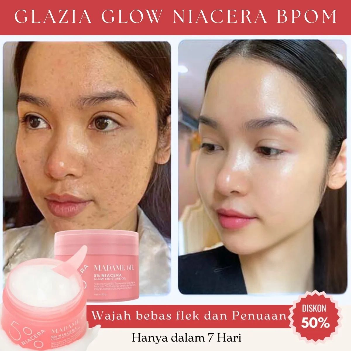 Glazia Glow Niacera BPOM GA BL77