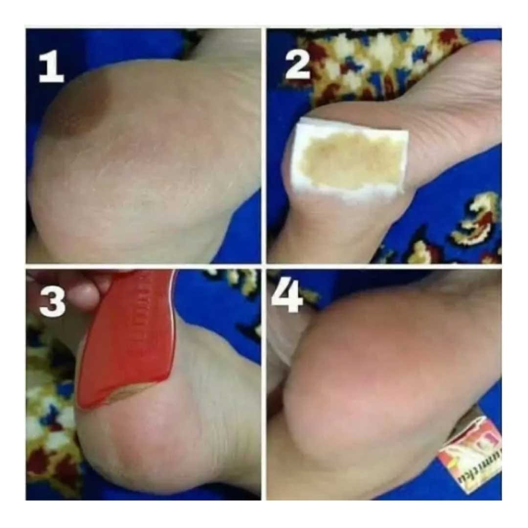 Tumitku Telapak Kaki Mulus