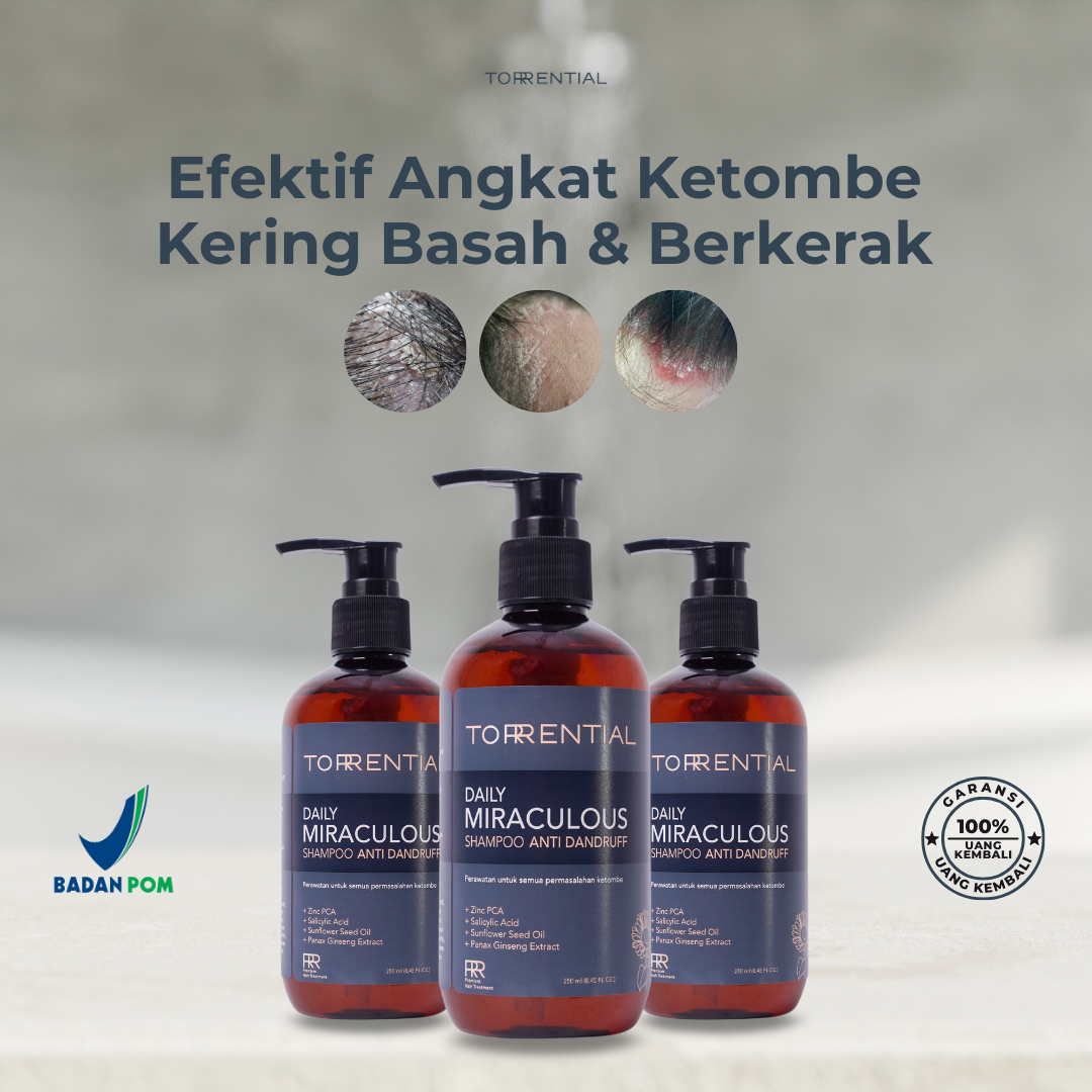 Torrential Shampoo Pembasmi Ketombe & Kutu - Tiktok TTU