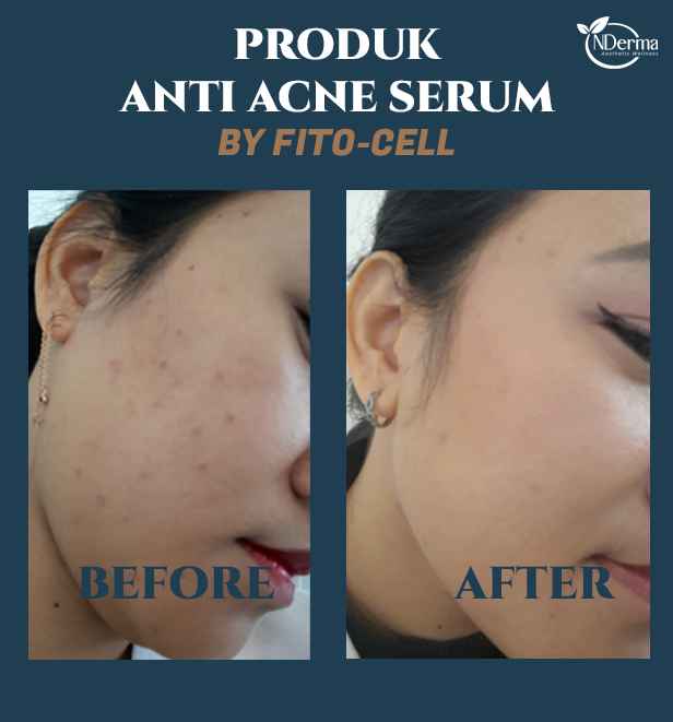 Produk Kecantikan