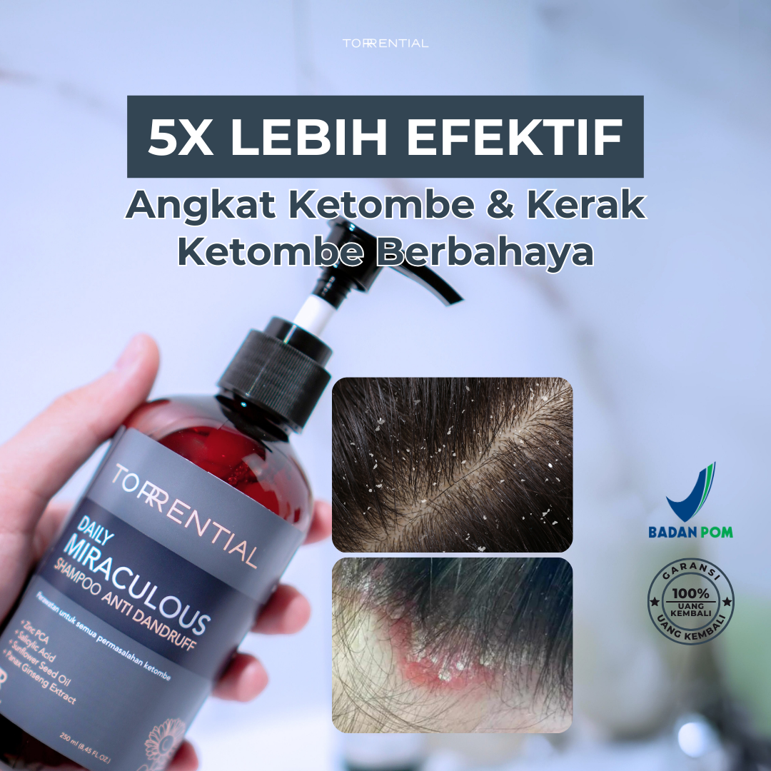 Torrential Shampoo Pembasmi Ketombe & Kutu - Tiktok TTU