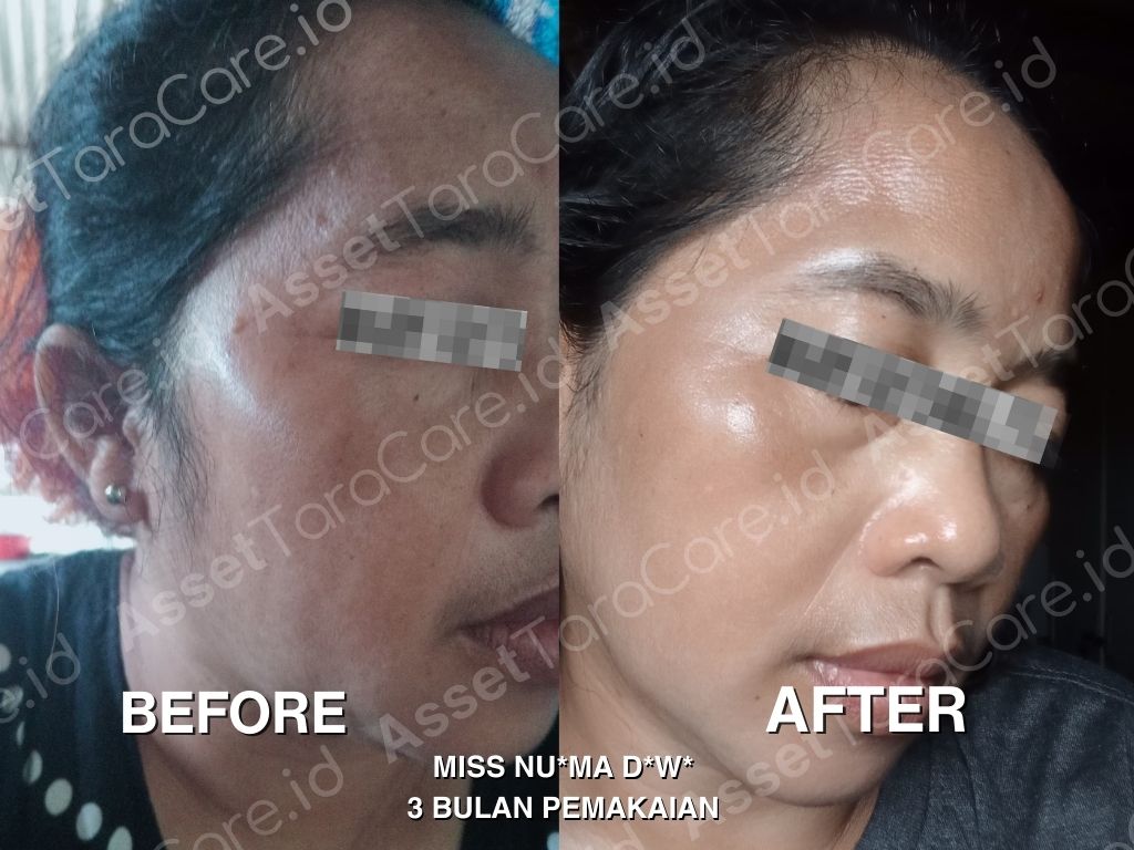 MWO - Taracare Whitening Skincare