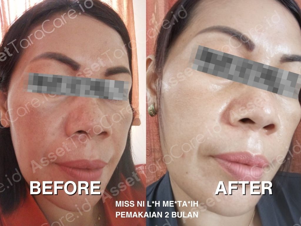 MWO - Taracare Whitening Skincare