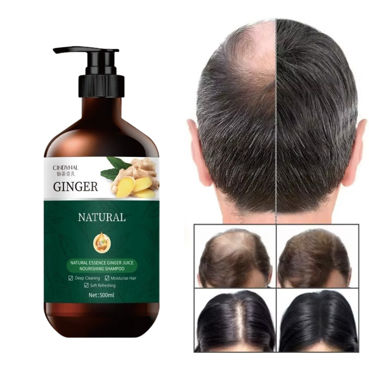 Cindynal Ginger HairCare Shampoo BPOM BL77-1069