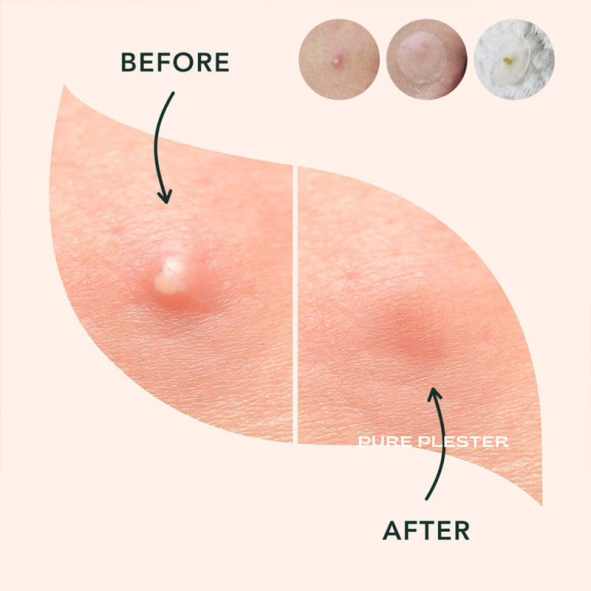 Bottle Cleaner Brush Detail