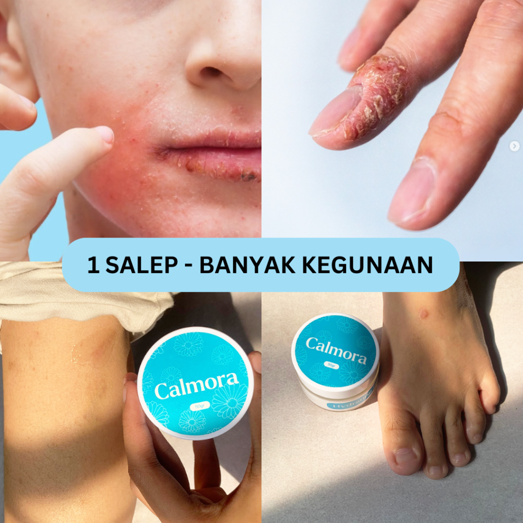 Rid Produk Salep Calmora Google Ads logo