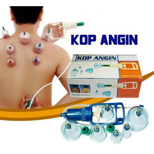 Alat Bekam Terapi Kesehatan - LD