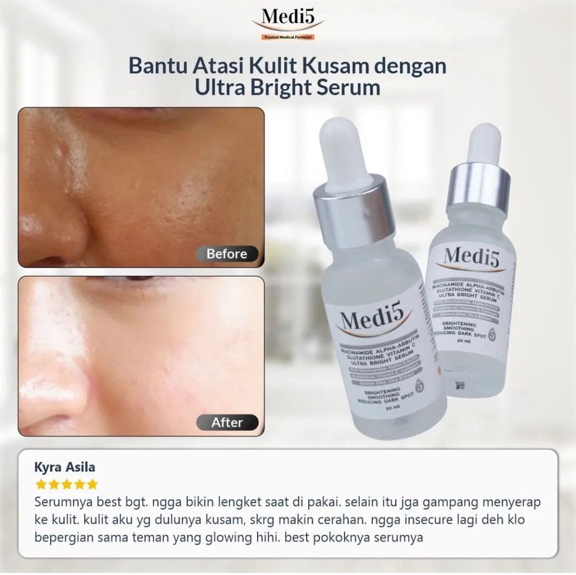 MEDI5 Ultra Bright Serum
