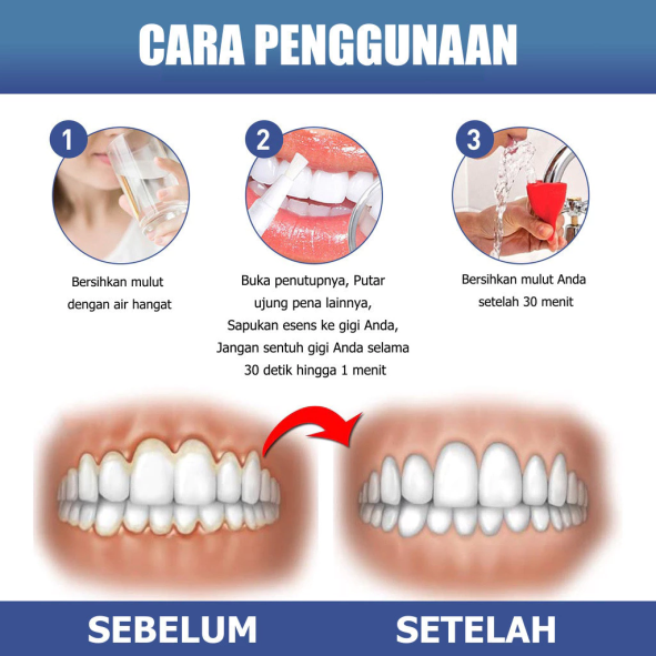Bottle Cleaner Brush Detail