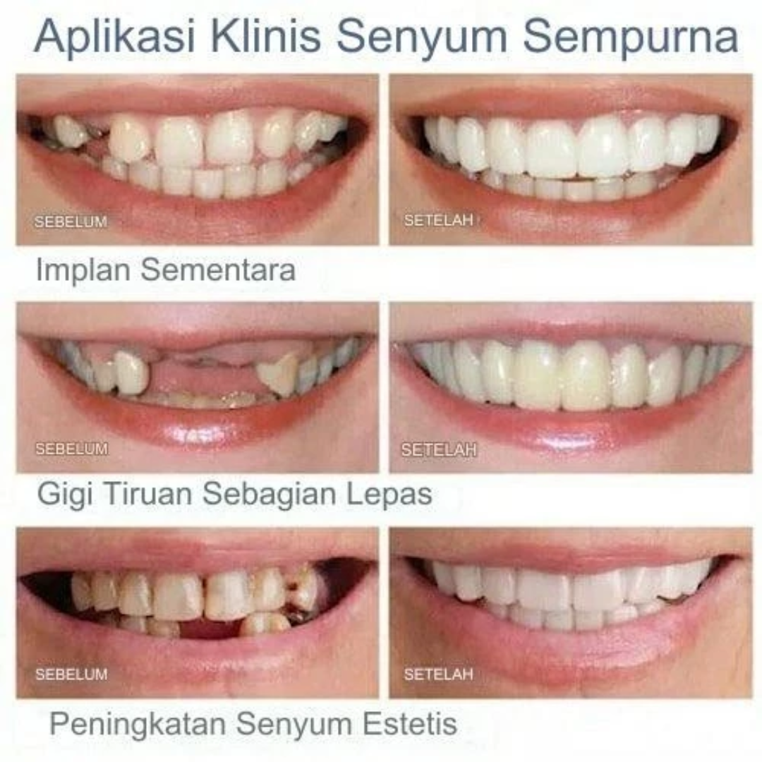 Temporary Dental Fillings