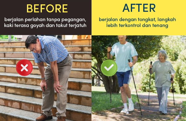 STEPWISE (Tongkat Lipat Tongkat Portabel Stainless) logo