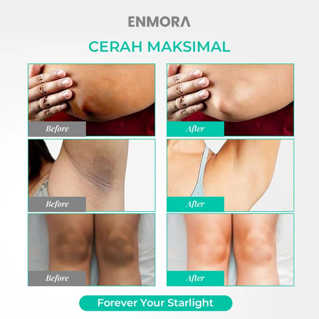 Enmora Underarm TOS