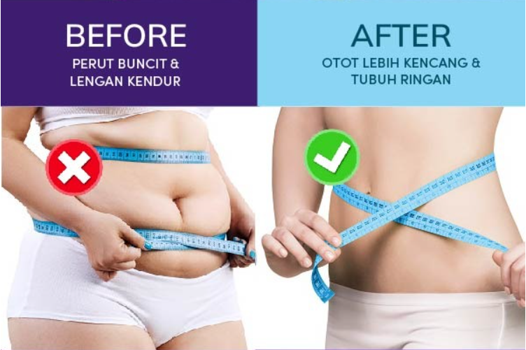 SLIMORA (alat pengencang dan pengecil perut) logo