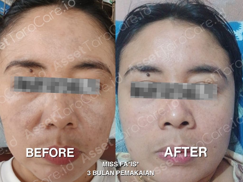 MWO - Taracare Whitening Skincare