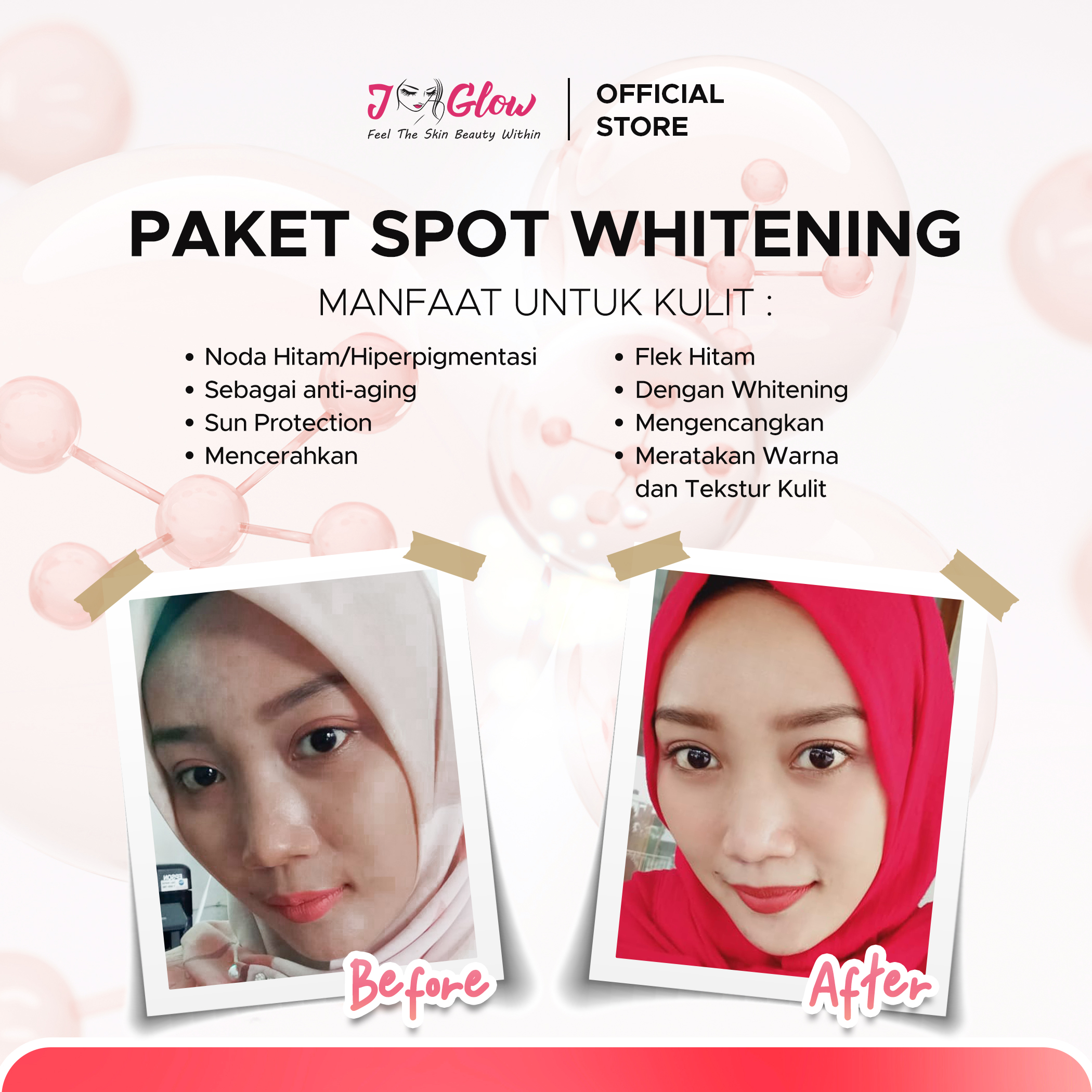 Paket Spot Whitening
