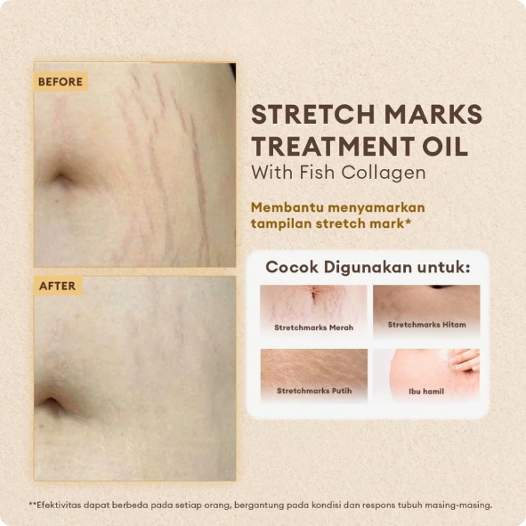 Oil Serum Stretchmark