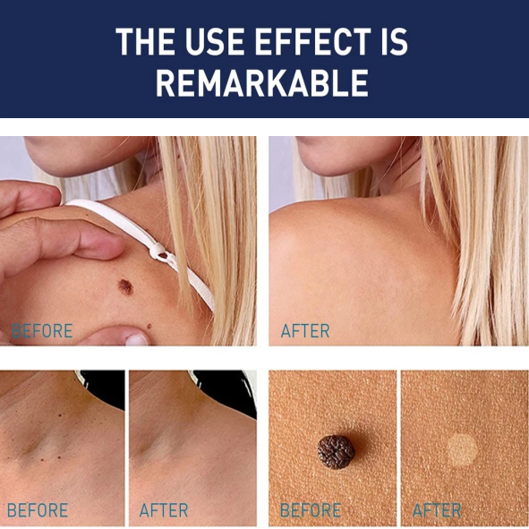 Bottle Cleaner Brush Detail