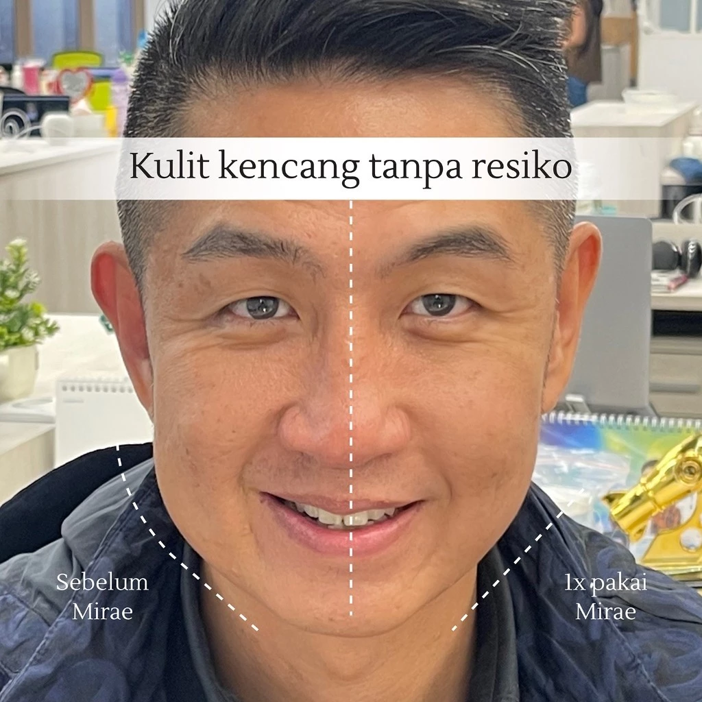 Mirae Cleaning Brush Detail